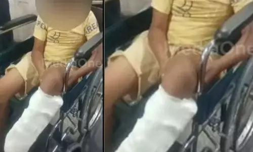 neighbor attack in kochi,ten-year-old leg broken,ten-year-olds foot Complaint of being beaten up by a neighbor,പത്തുവയസുകാരന്‍റെ കാല്‍ തല്ലിയൊടിച്ചു