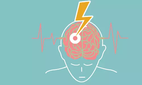 prevent stroke, stroke,lifestyle changes,health news,സ്ട്രോക്ക്,ജീവിതശൈലി,ഹെല്‍ത്ത് ന്യൂസ്