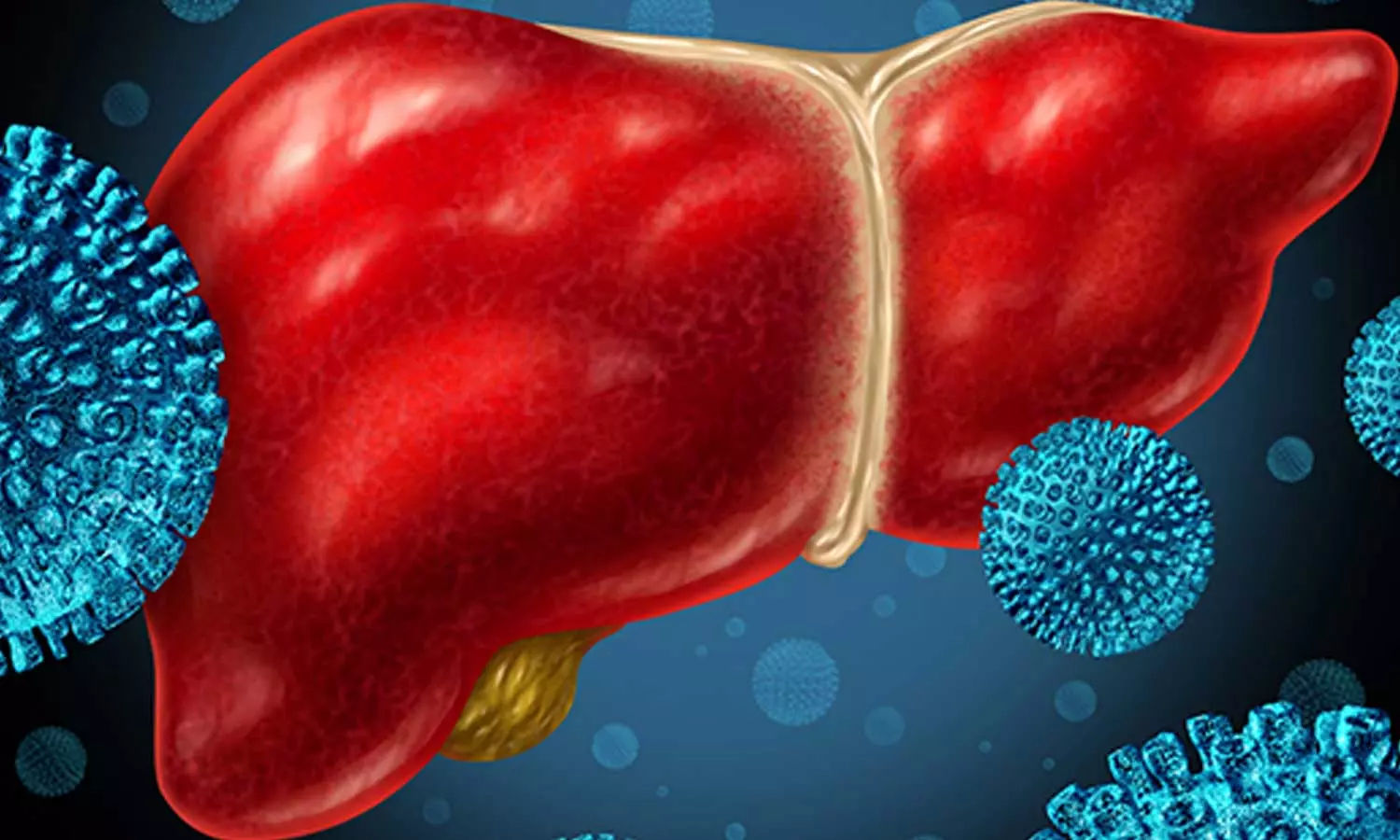 വൈറൽ ഹെപറ്റൈറ്റിസ് വൈറൽ ഹെപറ്റൈറ്റിസ്