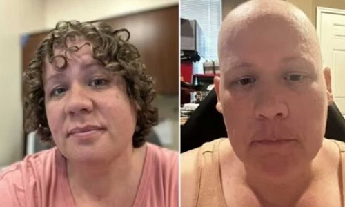 ഇല്ലാത്ത കാൻസർ വിധിയെഴുതി ഡോക്ടർ;   യുവതിക്ക് കീമോ ചെയ്യേണ്ടിവന്നത് 15 മാസം