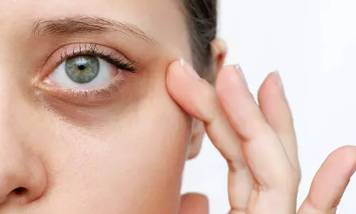 black mark under eye