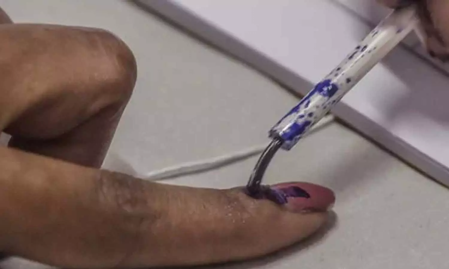 വോട്ടിങ് മഷി പുരട്ടുന്ന ജോലി ചെയ്ത വിദ്യാർഥിനിയുടെ കൈവിരലിൽ പഴുപ്പ് ബാധിച്ച് ഗുരുതരാവസ്ഥയിൽ വോട്ടിങ് മഷി പുരട്ടുന്ന ജോലി ചെയ്ത വിദ്യാർഥിനിയുടെ കൈവിരലിൽ പഴുപ്പ് ബാധിച്ച് ഗുരുതരാവസ്ഥയിൽ