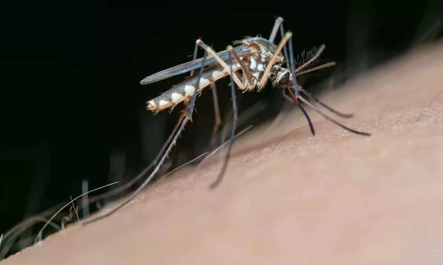 West Nile fever; Experts say not to worry West Nile fever; Experts say not to worry