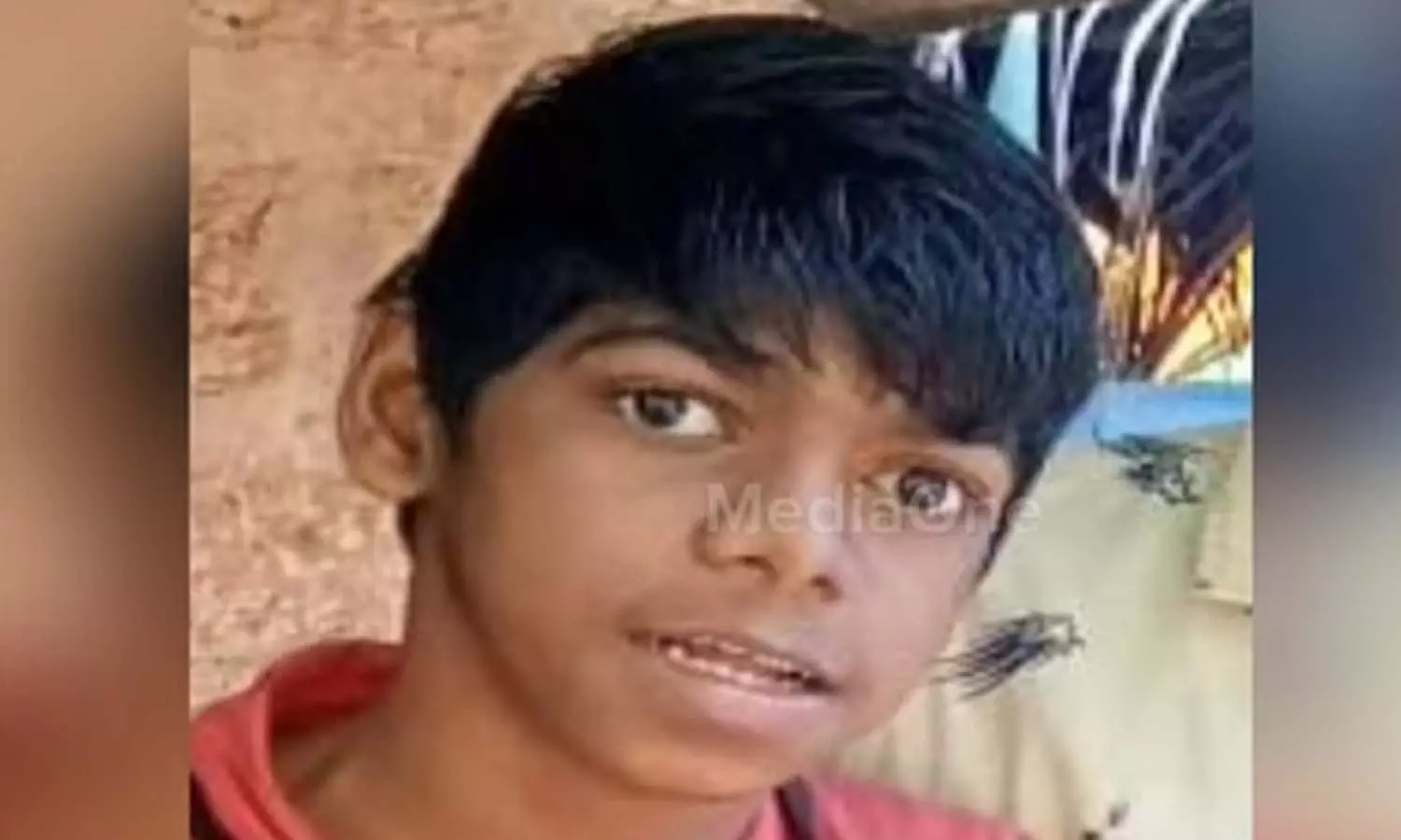 malappuram two death report jaundice