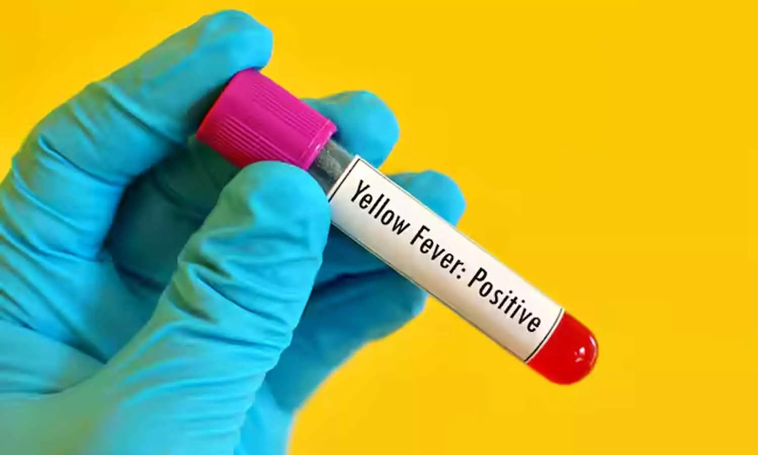 Yellow Fever Yellow Fever