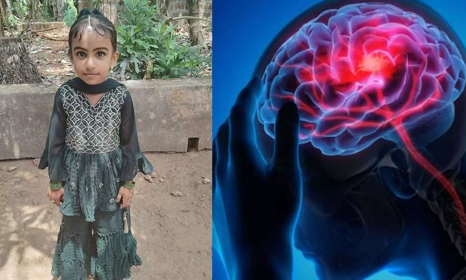 Amoebic encephalitis Amoebic encephalitis