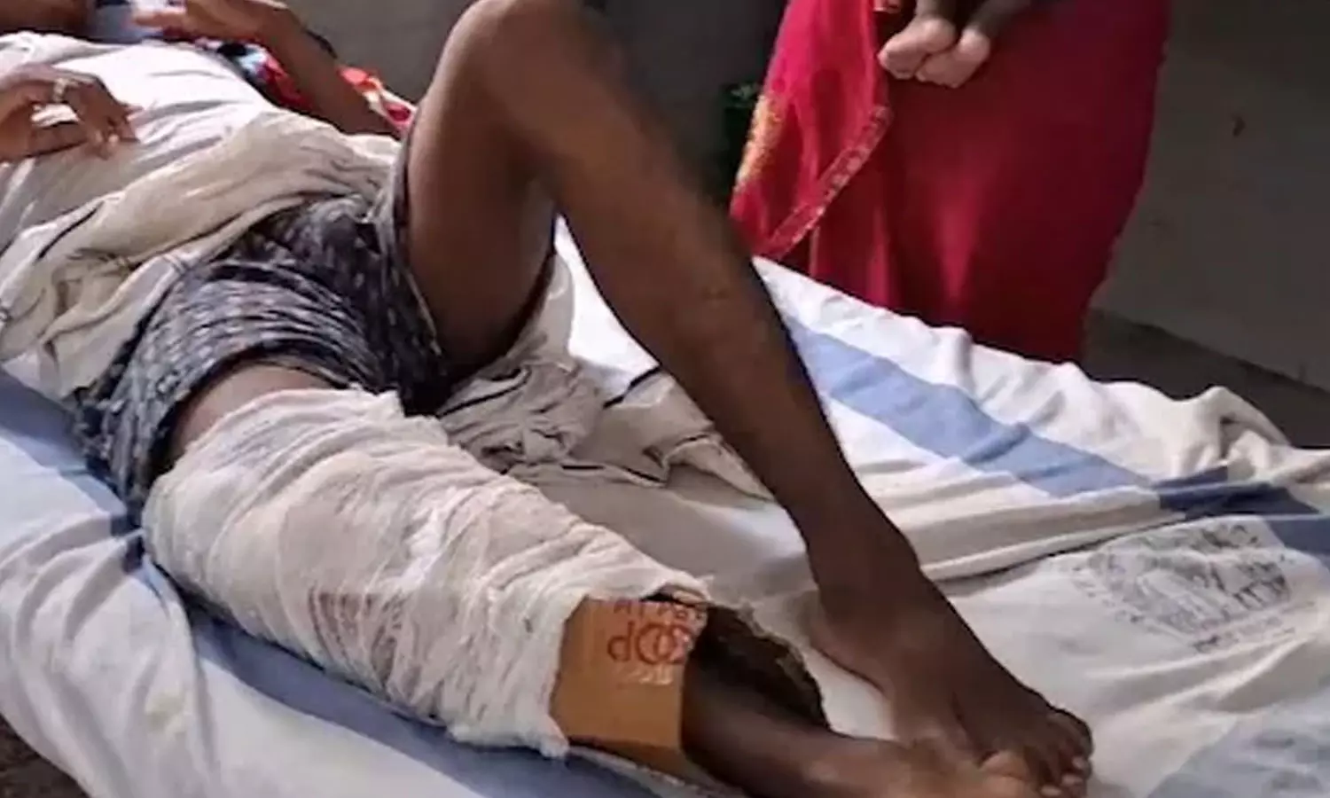 Bihar,cardboard carton , Health Centre,latest national news,പ്ലാസ്റ്ററിന് പകരം കാര്ബോര്ഡ്,ചികിത്സാപിഴവ്,ബിഹാര് Bihar,cardboard carton , Health Centre,latest national news,പ്ലാസ്റ്ററിന് പകരം കാര്ബോര്ഡ്,ചികിത്സാപിഴവ്,ബിഹാര്