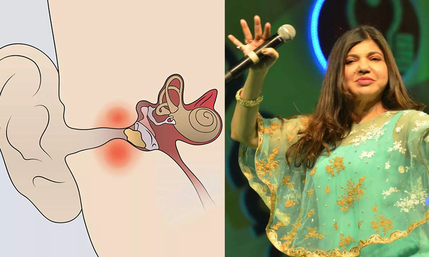 What happened to the famous Indian playback singer Alka Yagnik? what is the rare Sensorineural hearing loss (SNHL) all about?