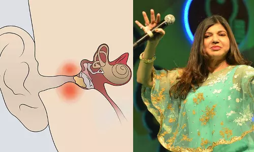 What happened to the famous Indian playback singer Alka Yagnik? what is the rare Sensorineural hearing loss (SNHL) all about?