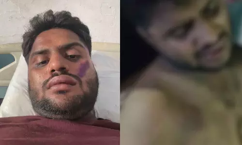 Mob assaults 25-yr-old doctor, Istekhar, after learning his name