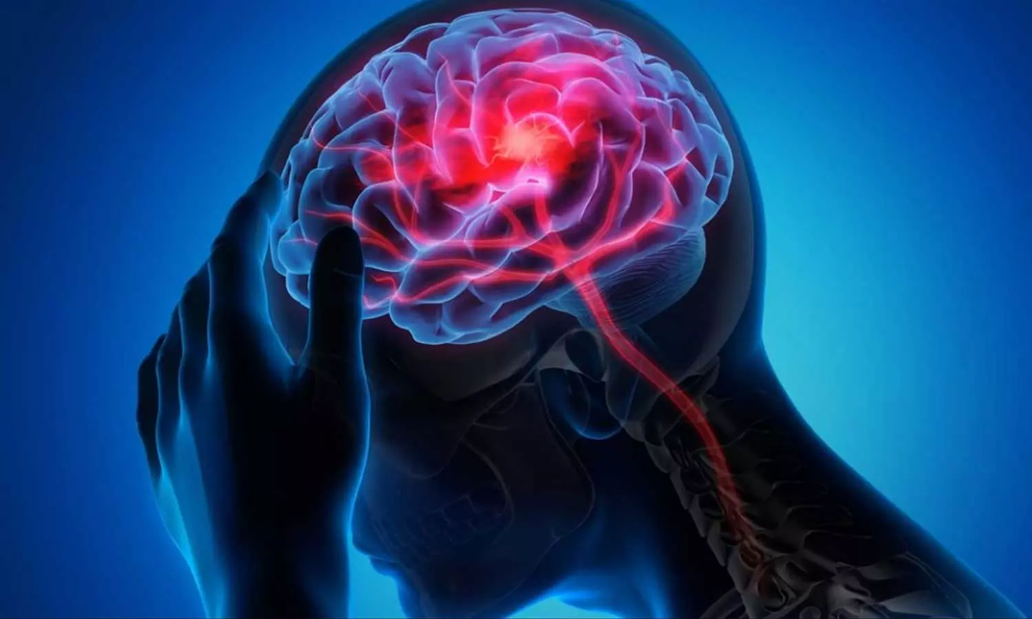 Amoebic meningoencephalitis