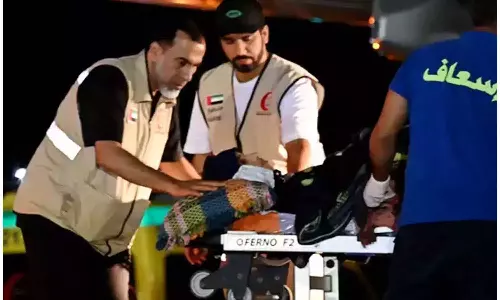 wounded and cancer patients from Gaza were brought to Abu Dhabi for treatment