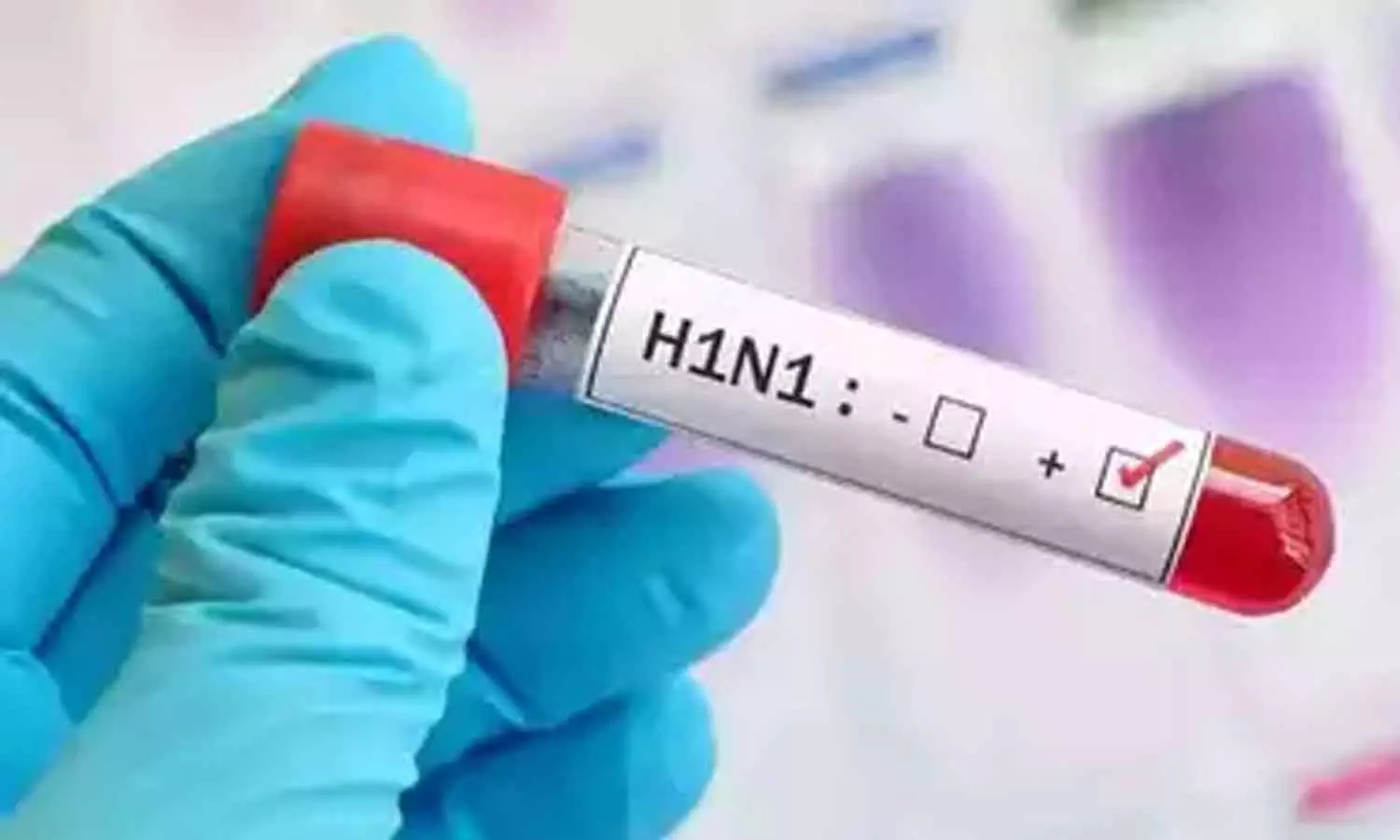 H1N1 confirmed in Malappuram H1N1 confirmed in Malappuram