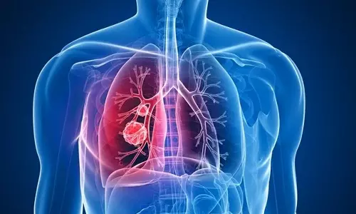 Lung Cancer,India ,health news,ശ്വാസകോശ അര്‍ബുദം,ഇന്ത്യയിലെ ശ്വാസകോശ അര്‍ബുദം