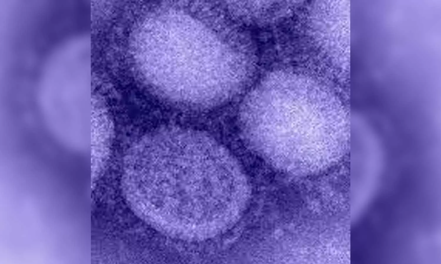 A 54-year-old man died of H1N1 in Thrissur, latest news malayalam, തൃശൂരിൽ എച്ച് 1 എൻ 1 ബാധിച്ച് 54കാരൻ മരിച്ചു A 54-year-old man died of H1N1 in Thrissur, latest news malayalam, തൃശൂരിൽ എച്ച് 1 എൻ 1 ബാധിച്ച് 54കാരൻ മരിച്ചു