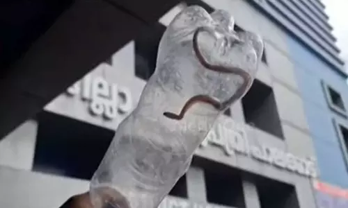 Woman bitten by snake in hospital: No poison found,latest news malayalam യുവതിക്ക് ആശുപത്രിയിൽ പാമ്പ് കടിയേറ്റ സംഭവം: വിഷം അകത്ത് ചെന്നിട്ടില്ലെന്ന് കണ്ടെത്തൽ