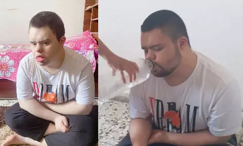 ഡൗണ് സിന്ഡ്രോം ബാധിച്ച ഗസ്സ യുവാവിനെ ഇസ്രായേല് സൈന്യം നായയ്ക്ക് ഇട്ടുകൊടുത്തു; കടിച്ചുകീറി കൊന്നു ഡൗണ് സിന്ഡ്രോം ബാധിച്ച ഗസ്സ യുവാവിനെ ഇസ്രായേല് സൈന്യം നായയ്ക്ക് ഇട്ടുകൊടുത്തു; കടിച്ചുകീറി കൊന്നു