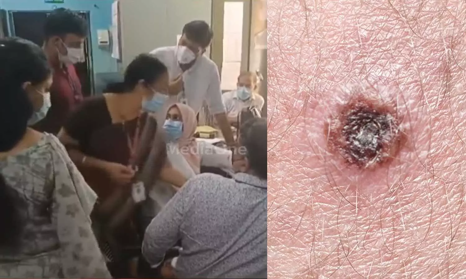 മലപ്പുറത്ത് നിപ ലക്ഷണങ്ങളുള്ള 15കാരന് ചെള്ളുപനി സ്ഥിരീകരിച്ചു