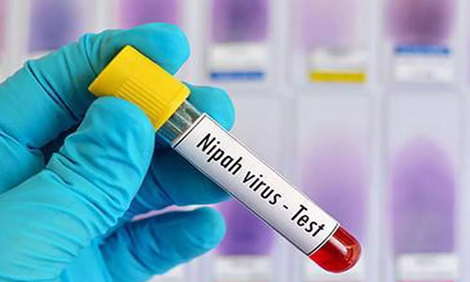 Antibody presence of Nipah virus in bat sample taken from Pandikkad