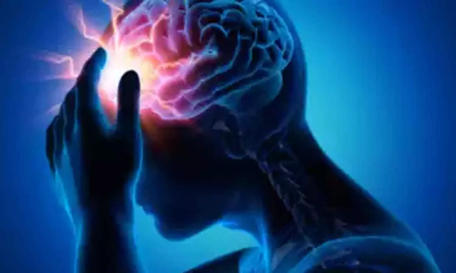 Amoebic meningo encephalitis Amoebic meningo encephalitis