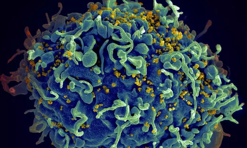 40 million people living with HIV in 2023 alone: ​​UN releases data, latest news