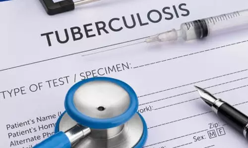 Mandatory Tuberculosis Test for Residency Applicants in Oman