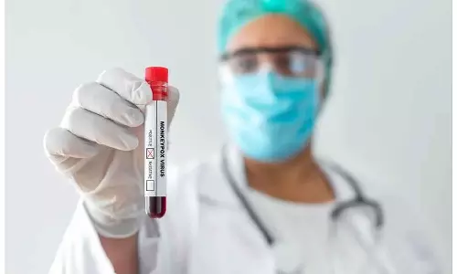 മങ്കിപോക്‌സ്: രോഗബാധ തടയാനാവശ്യമായ എല്ലാ മുൻകരുതലുകളും സ്വീകരിച്ചതായി കുവൈത്ത് ആഗോഗ്യ മന്ത്രാലയം