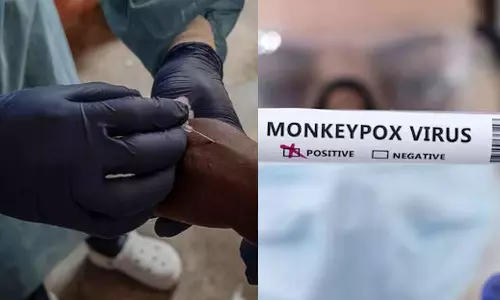 മങ്കി പോക്‌സ്: ഇന്ത്യയിൽ ആശങ്കപ്പെടേണ്ട സാഹചര്യമില്ല; ജാഗ്രതാ നിർദേശം