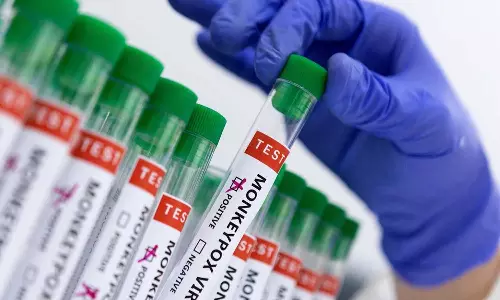 എം പോക്സ്; സംസ്ഥാനം ജാഗ്രത പാലിക്കണമെന്ന് ആരോഗ്യ മന്ത്രി