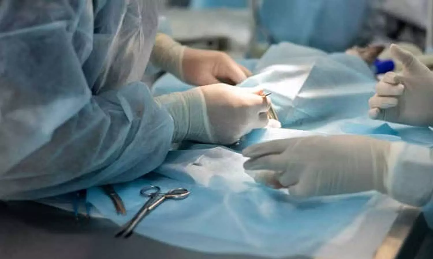 Five transgender people booked for castrating 18 year boy in Bengaluru Five transgender people booked for castrating 18 year boy in Bengaluru