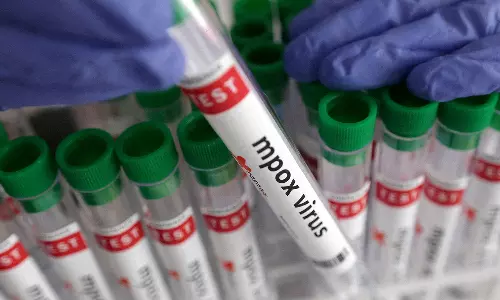 Mpox Outbreak In Africa Could Be Controlled In Six Months, Says WHO Chief