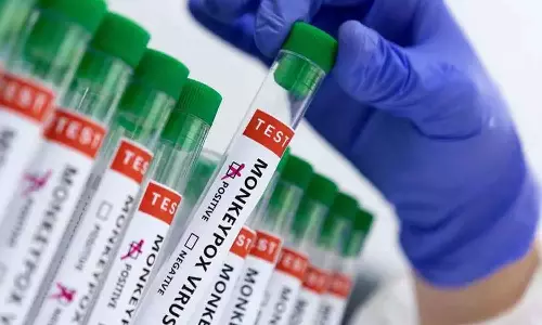 കുരങ്ങുപനിയെ നേരിടാനൊരുങ്ങി സൗദി; വാക്‌സിൻ, വിഷ്വൽ സ്‌ക്രീനിംഗ് എന്നിവ സംവിധാനിച്ചു