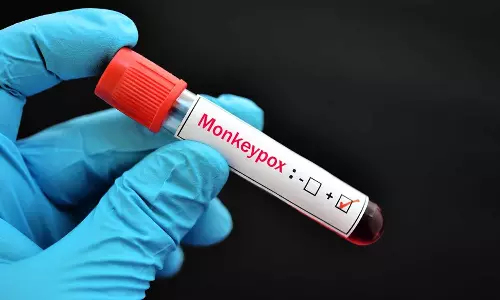 വിദേശത്ത് നിന്നെത്തിയ യുവാവിന് മങ്കിപോക്സ് ലക്ഷണം