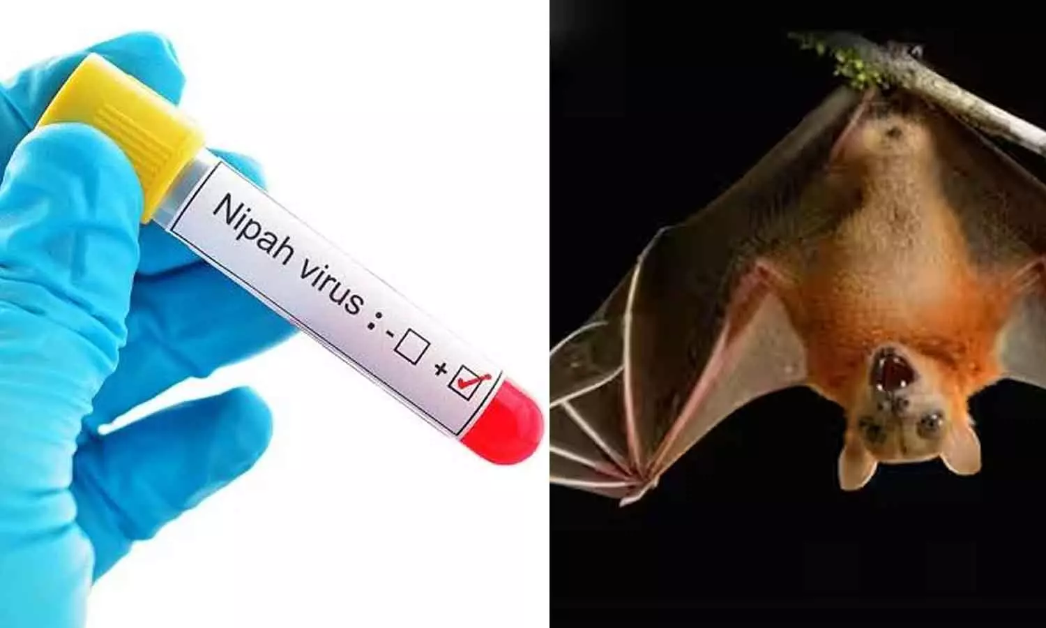 Relief in Nipah; 10 people, including the mother, relatives and the doctor who treated the deceased, tested negative, latest news malayalam, നിപയിൽ ആശ്വാസം; മരിച്ച യുവാവിൻറെ മാതാവും ബന്ധുക്കളും ചികിത്സിച്ച ഡോക്ടറും ഉൾപ്പെടെ 10 പേരും നെഗറ്റീവ് Relief in Nipah; 10 people, including the mother, relatives and the doctor who treated the deceased, tested negative, latest news malayalam, നിപയിൽ ആശ്വാസം; മരിച്ച യുവാവിൻറെ മാതാവും ബന്ധുക്കളും ചികിത്സിച്ച ഡോക്ടറും ഉൾപ്പെടെ 10 പേരും നെഗറ്റീവ്