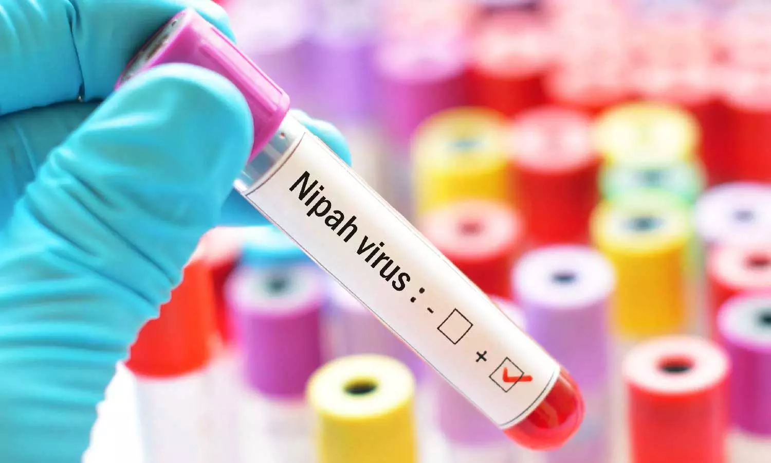 175 People In The Contact list of Nipah Affected Man and Included 74 health workers 175 People In The Contact list of Nipah Affected Man and Included 74 health workers