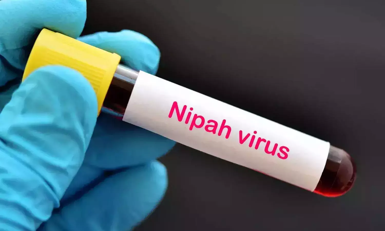 കേരളത്തിലെ നിപ മരണം; അതിർത്തികളിൽ കർശന പരിശോധന നടത്താൻ തമിഴ്നാട് സർക്കാർ കേരളത്തിലെ നിപ മരണം; അതിർത്തികളിൽ കർശന പരിശോധന നടത്താൻ തമിഴ്നാട് സർക്കാർ