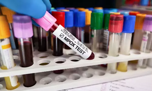 എംപോക്‌സ്; മലപ്പുറത്ത് കൂടുതല്‍ ജാഗ്രത, 23 പേർ നിരീക്ഷണത്തിൽ