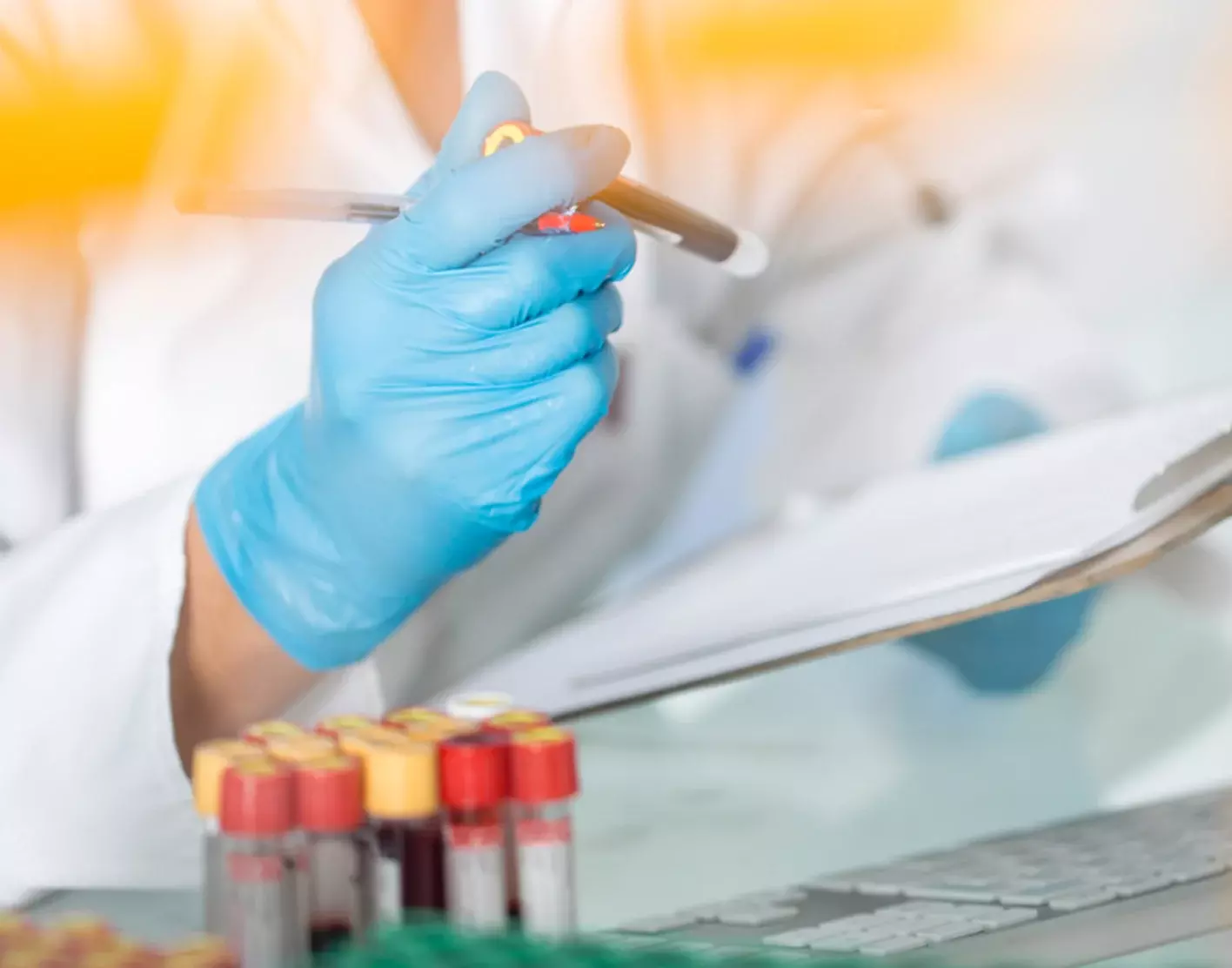 jaundice test result