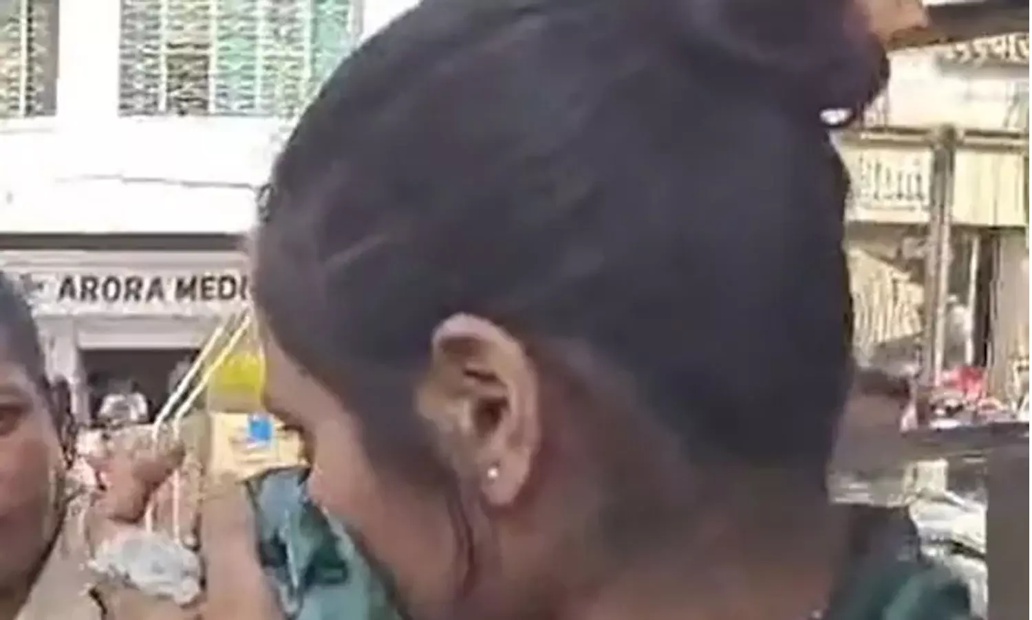 വിവാഹ വാഗ്ദാനം നൽകി പറ്റിച്ചു, ഭീഷണിപ്പെടുത്തി:മുന്‍ കാമുകന്‍റെ ദേഹത്ത് ആസിഡ് ഒഴിച്ച് യുവതി