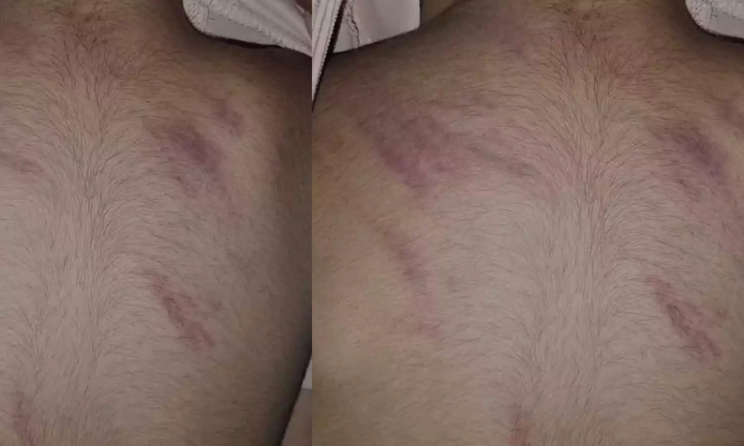 കൊച്ചിയിൽ മൂന്നര വയസുകാരനെ ക്രൂരമായി മർദിച്ച് അധ്യാപിക