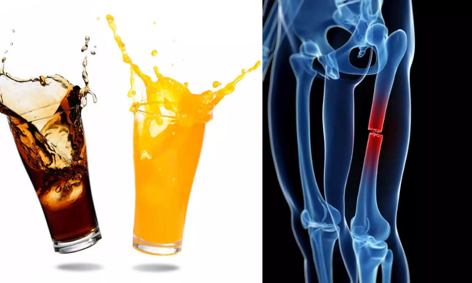 soft drink, bone health, study, latest news,