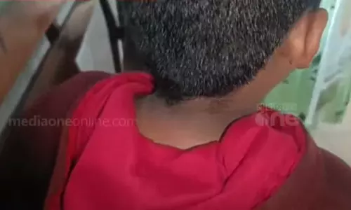Teacher Alleges beat up class Seven student in Thiruvananthapuram