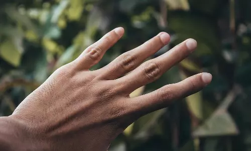 ജോലിയിൽ തുടരാൻ താൽപര്യമില്ല; ഗുജറാത്തിൽ വിരലുകൾ മുറിച്ചുമാറ്റി യുവാവ്