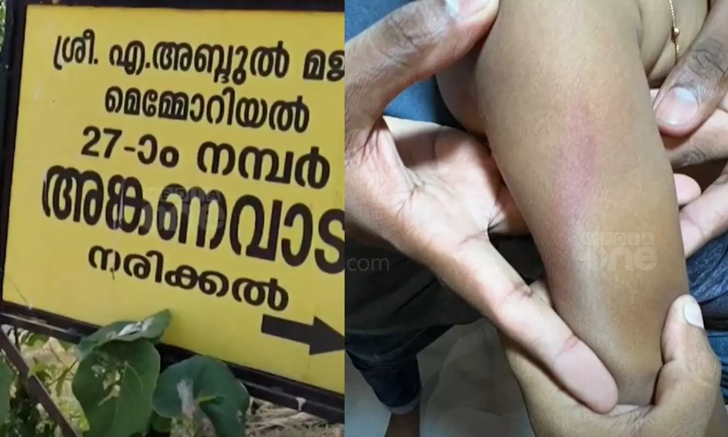 രണ്ടര വയസ്സുകാരിയെ കമ്പി കൊണ്ട് അടിച്ച സംഭവം: അങ്കണവാടി ടീച്ചർക്ക് സസ്പെൻഷൻ