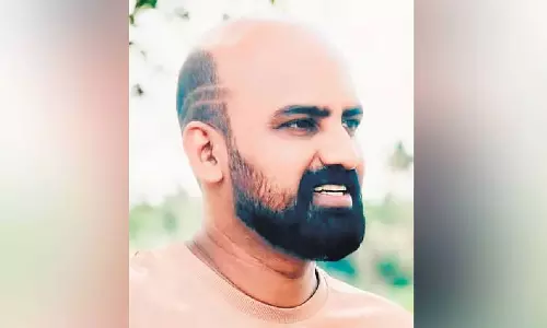 മൊട്ടത്തലയിൽ ബ്രാൻഡുകൾക്ക് പരസ്യം ചെയ്യാം; വ്യത്യസ്ത ആശയവുമായി മലയാളി യൂട്യൂബർ