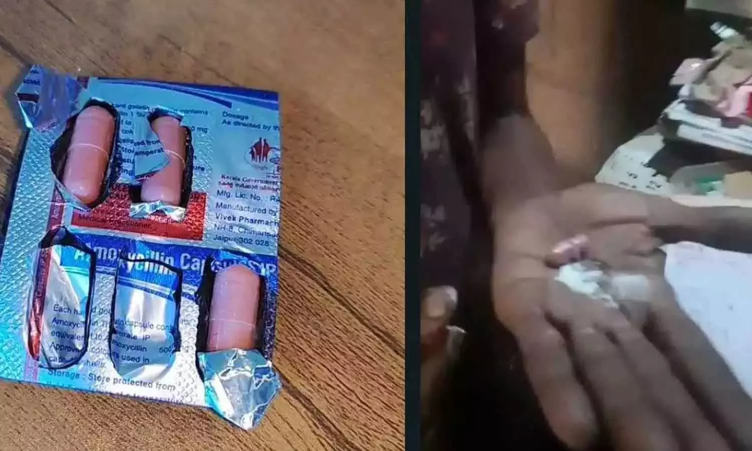 ഗുളികയിൽ സൂചി കണ്ടെത്തിയ സംഭവത്തിൽ പൊലീസ് കേസെടുത്തു; വ്യാജ ആരോപണമെന്ന് ആരോഗ്യവകുപ്പ് ഗുളികയിൽ സൂചി കണ്ടെത്തിയ സംഭവത്തിൽ പൊലീസ് കേസെടുത്തു; വ്യാജ ആരോപണമെന്ന് ആരോഗ്യവകുപ്പ്