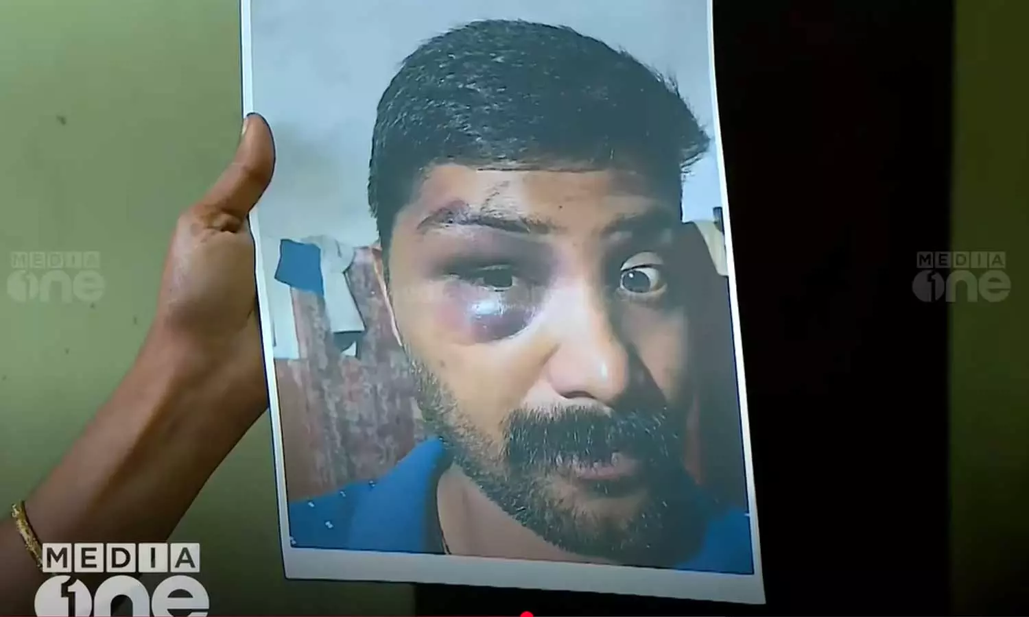 കൊല്ലത്ത് സൈനികന്റെ മരണം ലോക്കപ്പ് മർദനം മൂലമെന്ന് പരാതി; കുണ്ടറ പോലീസിൽ നിന്ന് നേരിട്ടത് ക്രൂര പീഡനമെന്ന് കുടുംബം