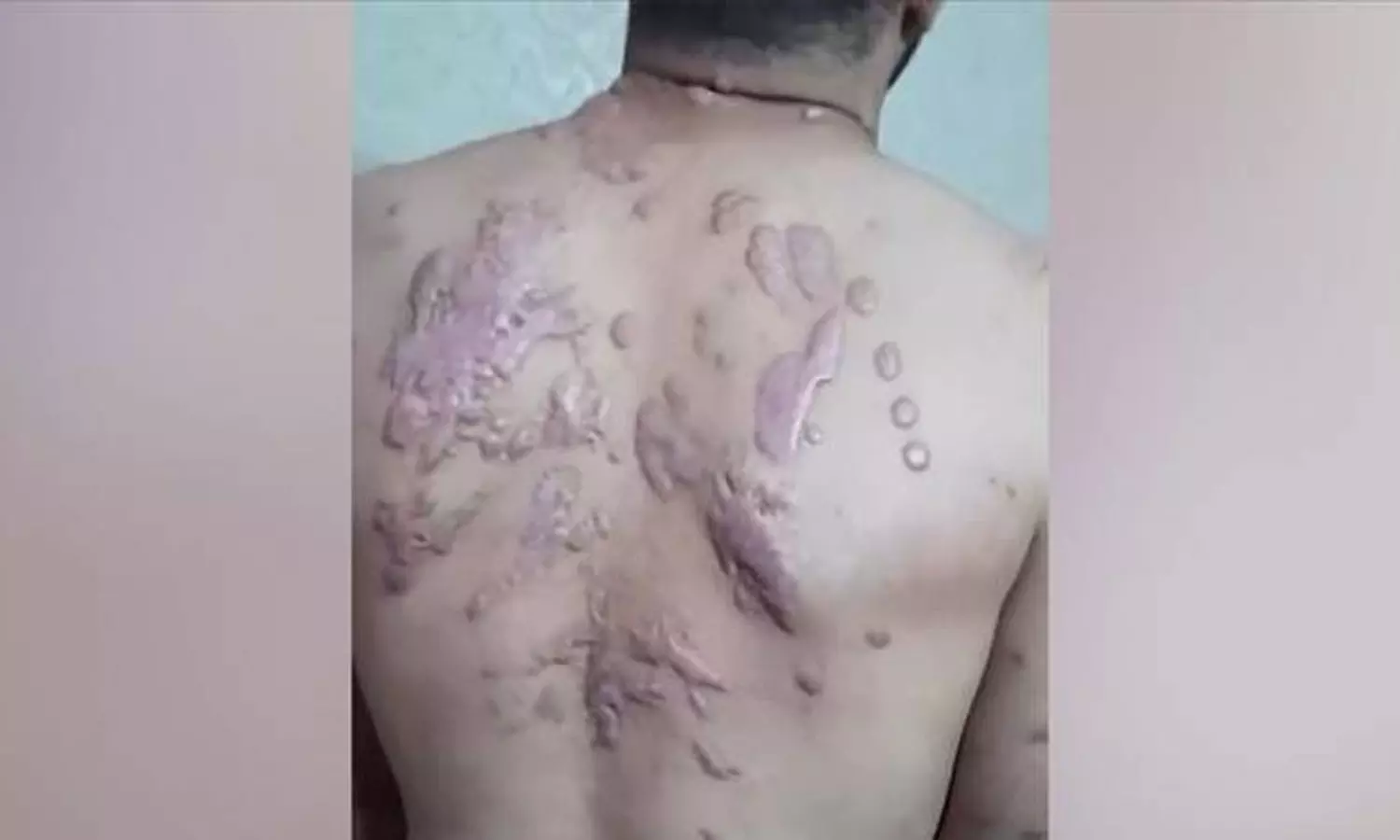 വൈദ്യുതാഘാതം, രാസായുധ പ്രയോഗം, ക്രൂരമായ മർദനം; ഇസ്രായേൽ സൈന്യത്തിന്റെ ക്രൂരതകളുടെ നേർചിത്രമായി ഫലസ്തീൻ തടവുകാർ