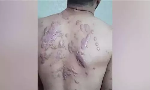 വൈദ്യുതാഘാതം, രാസായുധ പ്രയോഗം, ക്രൂരമായ മർദനം; ഇസ്രായേൽ സൈന്യത്തിന്റെ ക്രൂരതകളുടെ നേർചിത്രമായി ഫലസ്തീൻ തടവുകാർ