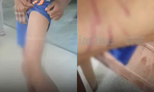 13 year old brutally beaten by drunk grandfather in Thiruvananthapuram